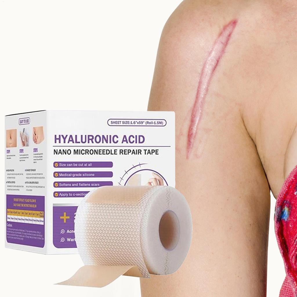 Soft Silicone Gel Scar Sheet for Acne Trauma Burn Scar Removal Skin Repair Ear Beauty Treatment