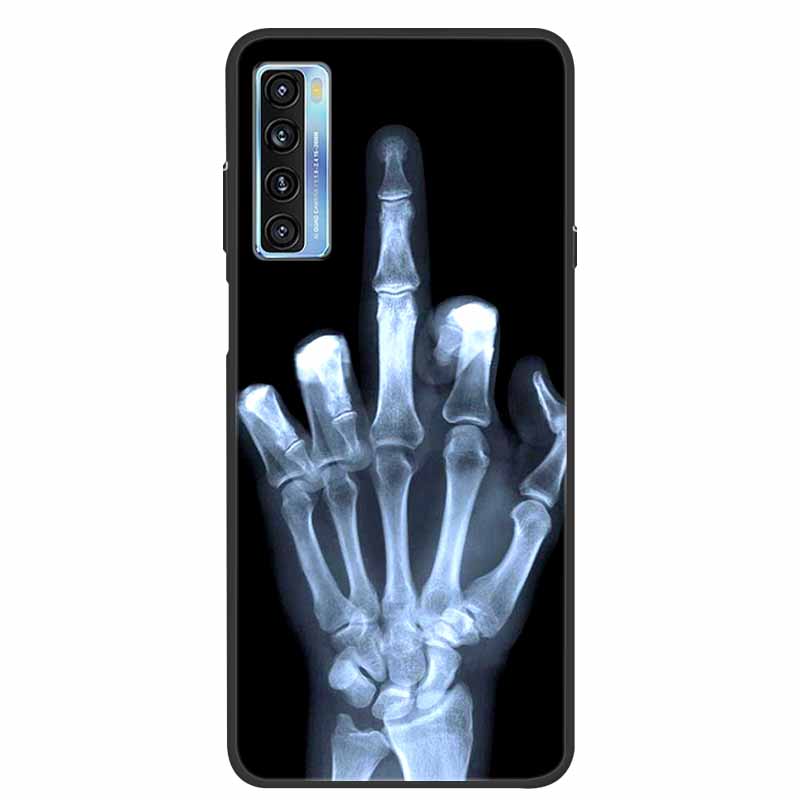 For TCL 20L Case Cute Painted Soft Silicone Back Cover for TCL 20L+ Plus T775H Phone Cases TPU Bumper For TCL 20S 20 L T774H