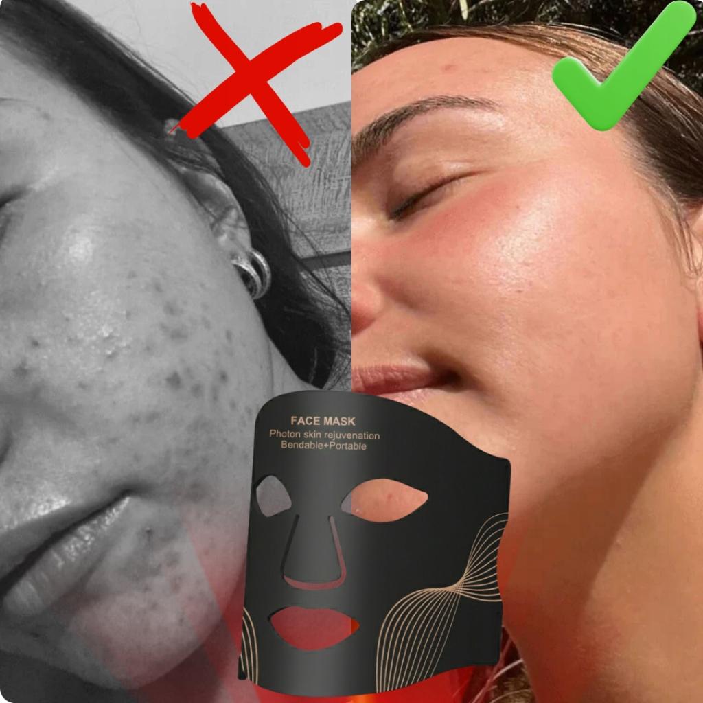 7-Color LED Face Mask - Light Therapy