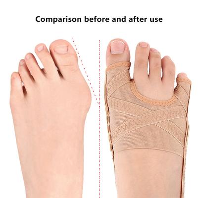 Durable And Safe Adjustable Hallux Valgus Bunion Corrector Orthotics Big Toe Separator Thumb Correction Pedicure Foot