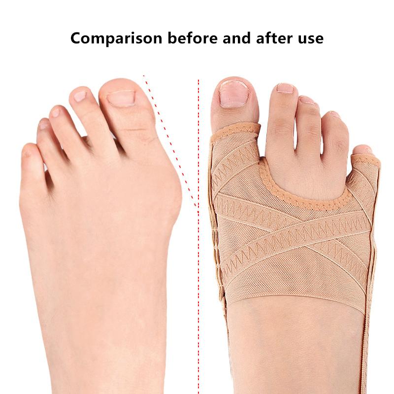 Adjustable  Bunion Corrector Orthotics Big Toe Separator Thumb Correction Pedicure Foot