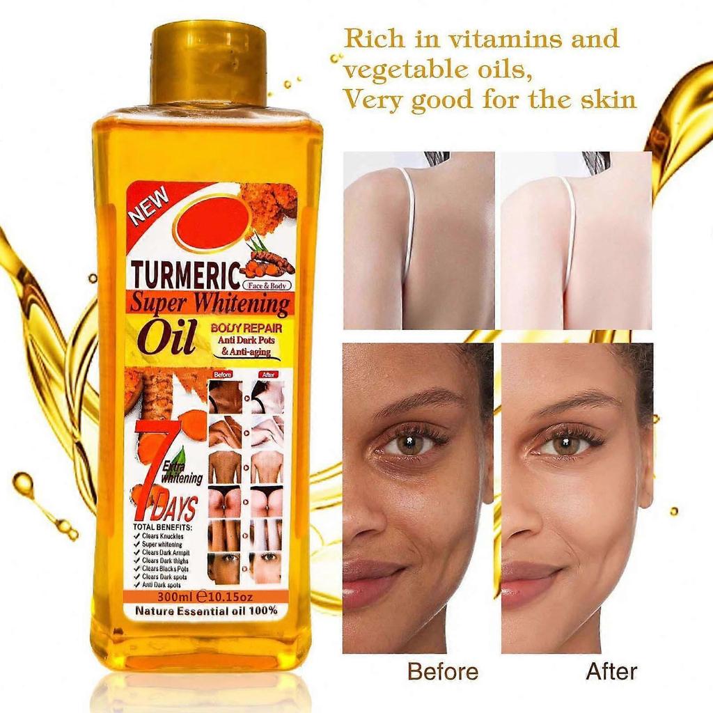 Turmeric Super Whitening Oil 300ml, Skin Lightening & Brightening, Fades Dark Spots, Natural Face & Body Oil