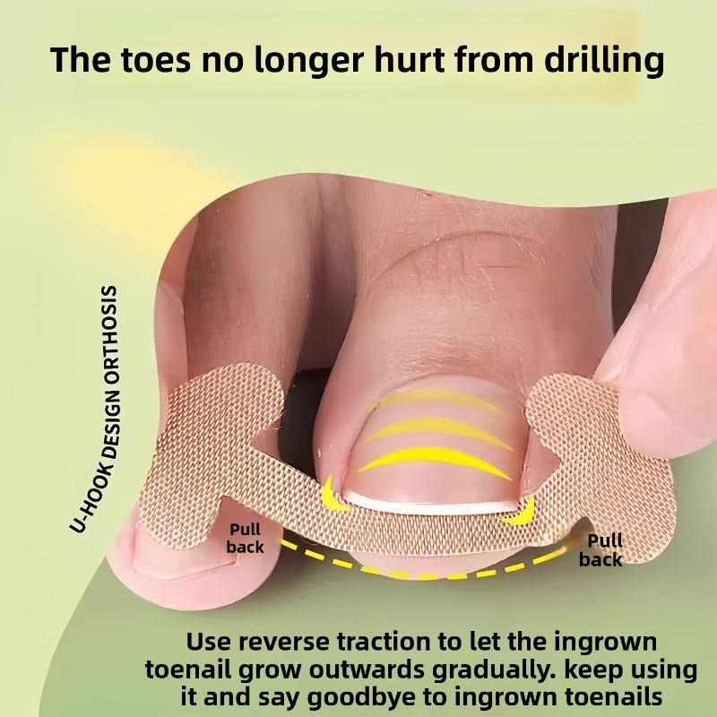 The Nail Improvement Tool for The Nail Groove - Isolates The Toenail, Allows for The Growth of The Nail, and Fills In The Area with A Padding Pad.