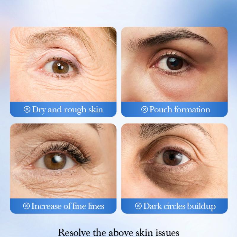 Blåbär Frukt Slät Ögonmask SADOER Återfuktande och Återfuktande Ögonmaskplåster