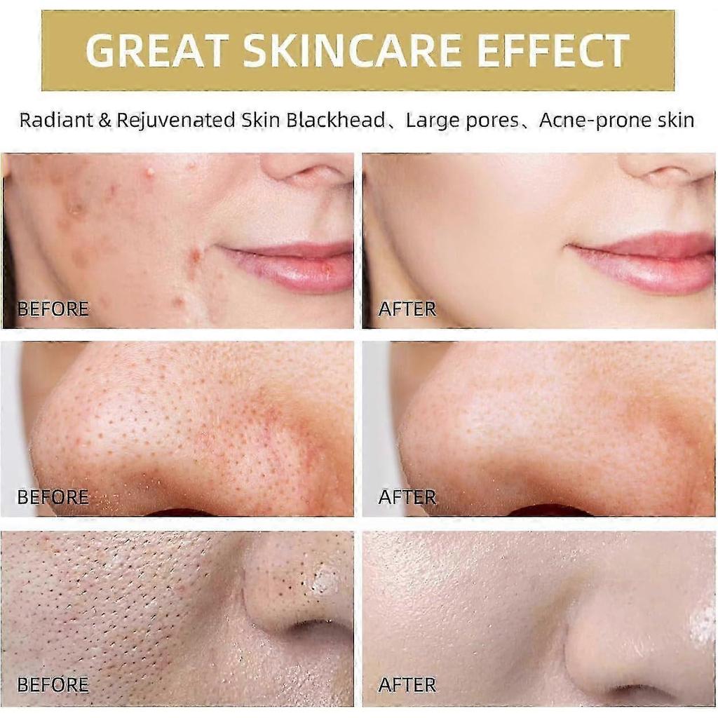 Masque Facial à l'Argile Vitamine C Curcuma, Masque à l'Argile Curcuma avec Vitamine C, Masque Facial Nettoyant en Profondeur, Améliore les Points Noirs Acné Taches Foncées 2025