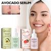 Limited time!!Eelhoe Watermelon Facial Serum Hydrates And Moisturizes, Leaves Skin Smooth And Delicate, Daily Care