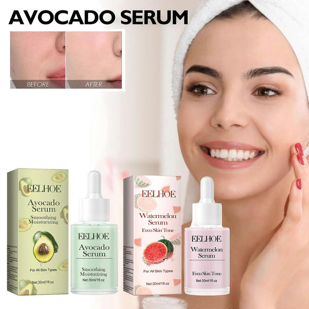 Limited time!!Eelhoe Watermelon Facial Serum Hydrates And Moisturizes, Leaves Skin Smooth And Delicate, Daily Care