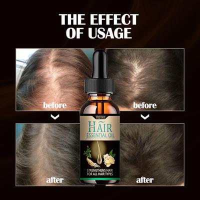 Hair Growth Serum Hair Care Product Hair Serum Fast Hair
