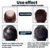 East Moon Men's Hair Treatment – Moisturizing & Nourishing Formula for Stronger, Smoother & Well-Groomed Hair