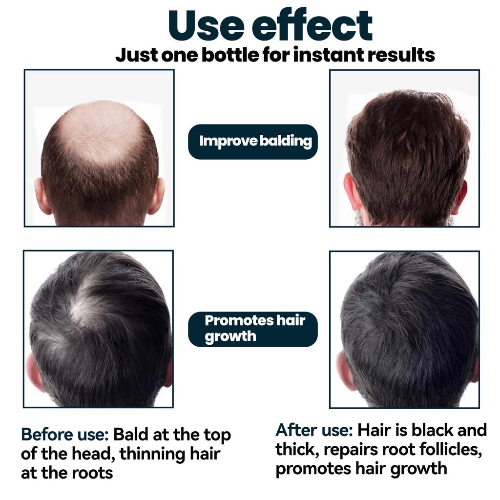East Moon Men's Hair Treatment – Moisturizing & Nourishing Formula for Stronger, Smoother & Well-Groomed Hair