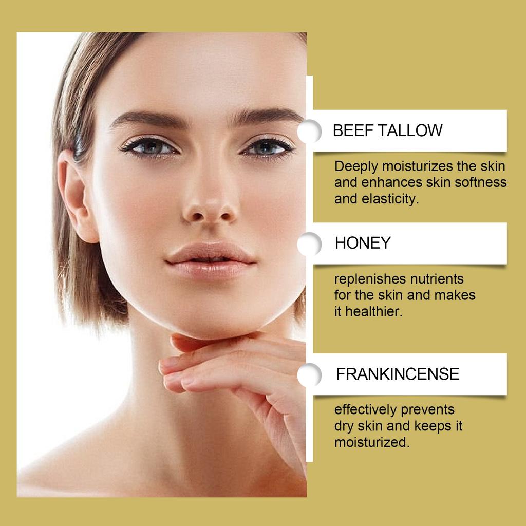 Beef Tallow Cream, Beef Tallow Balm, Beef Tallow Cream, Grass Fed Tallow And Honey Cream, For Face And Body, Provides All Skin Types