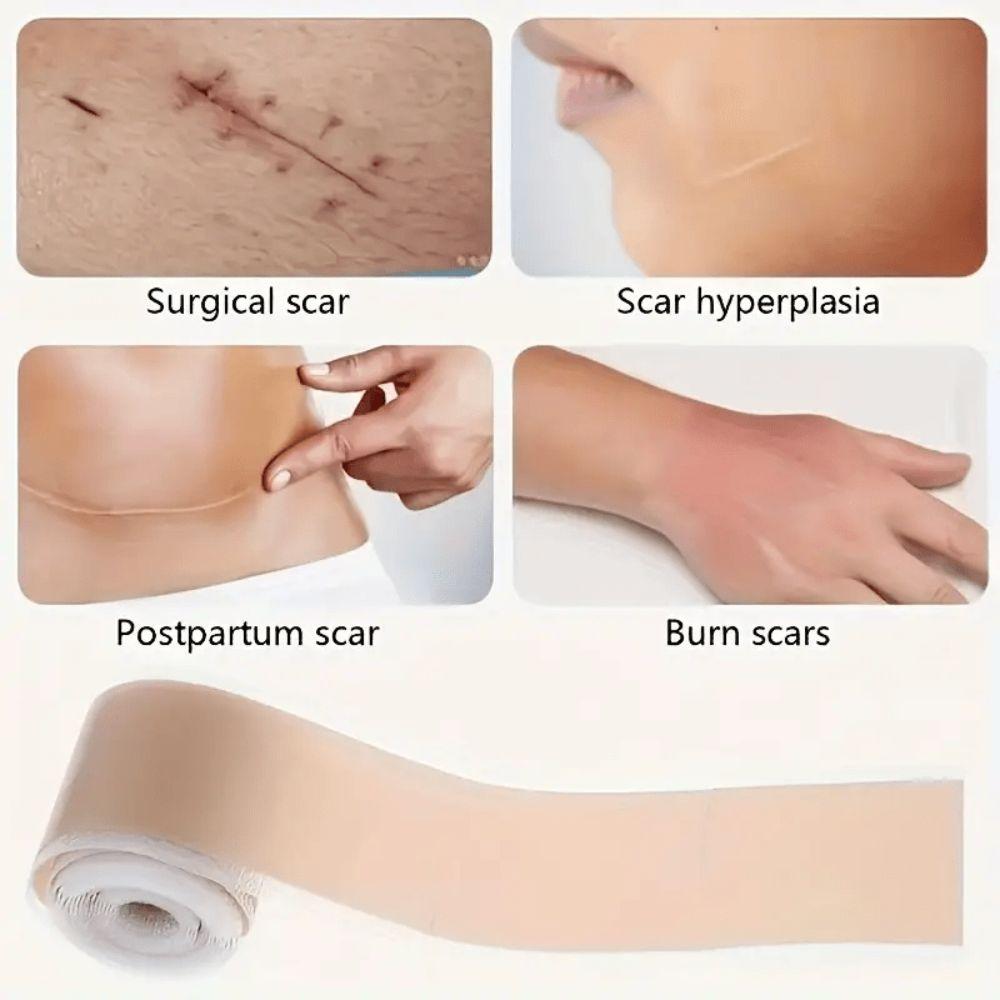 Self-Adhesive Silicone Scar Sheets Roll Reusable Skin Cover Tape Cesarean Section