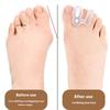 1Pair Orthopedic Bunion Corrector Silicone Hammer Toe Straightener with 6 Sponge Plugs Hallux Valgus Regulator Toe Separator