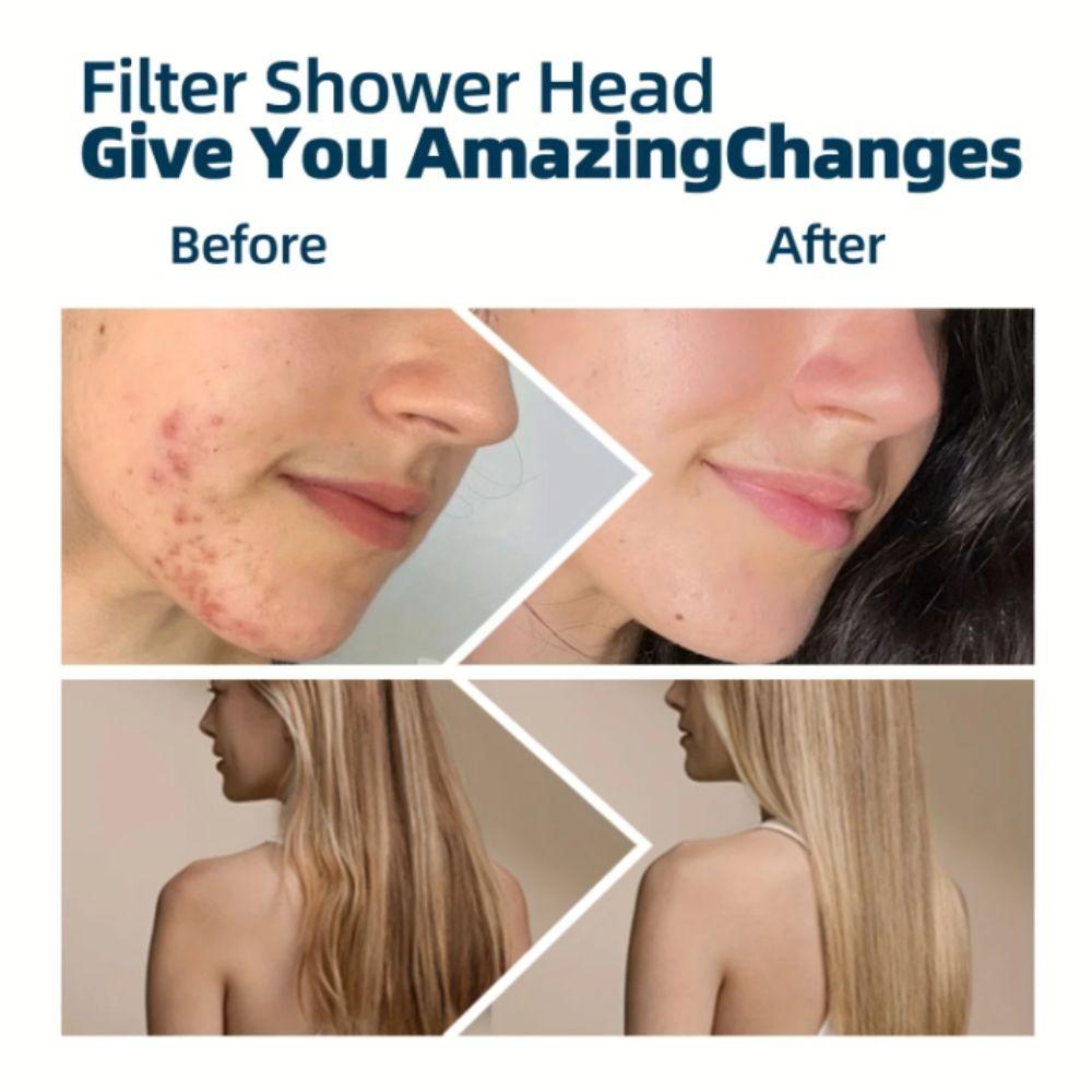 Adjustable Nozzle Shower Head Filter Reduce Skin Dryness Hard Water Filter  Water Purification