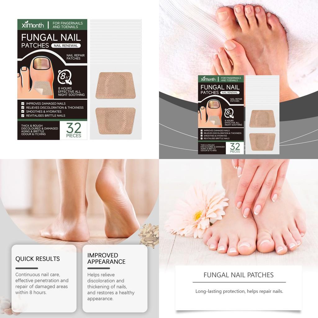Ximonth Nagelreparatur-Pflaster Sanfte Pflegende Formel Für Hände Und Füße Natürlicher Glanz