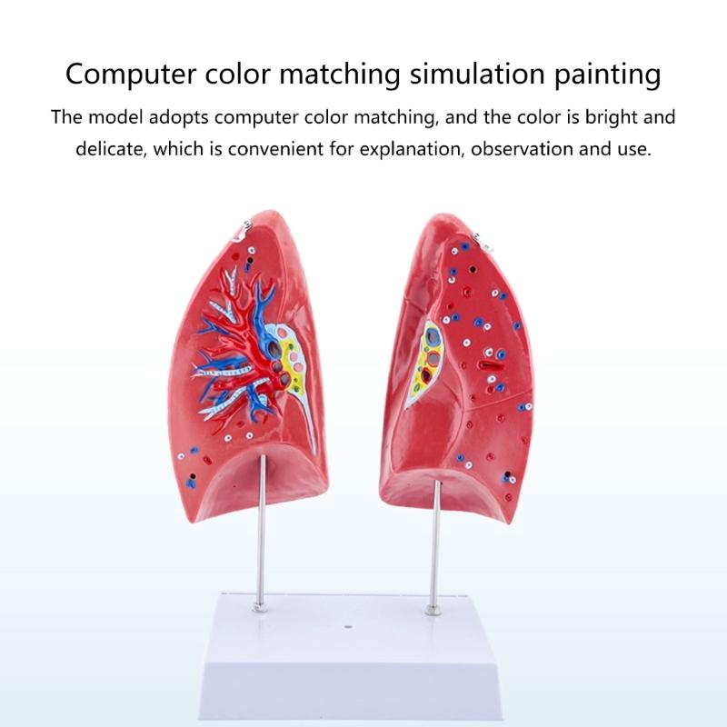Human Anatomical Lung Model with Detachable Parts Normal Lung Anatomy Model for Clinical Settings and Lecture Report