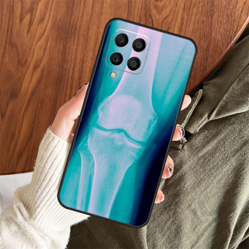X-Ray Human Anatomy Case For Samsung Galaxy M11 M21 M31 M35 M12 M13 M14 M15 M16 M36 M56 M53 M32 M52 M55 M34 M54