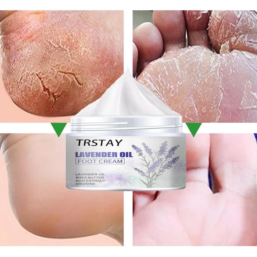 Gentle and Non-irritating, the Chapped Foot Repair Cream Hydrates and Nourishes the Skin, Leaving It Soft and Delicate