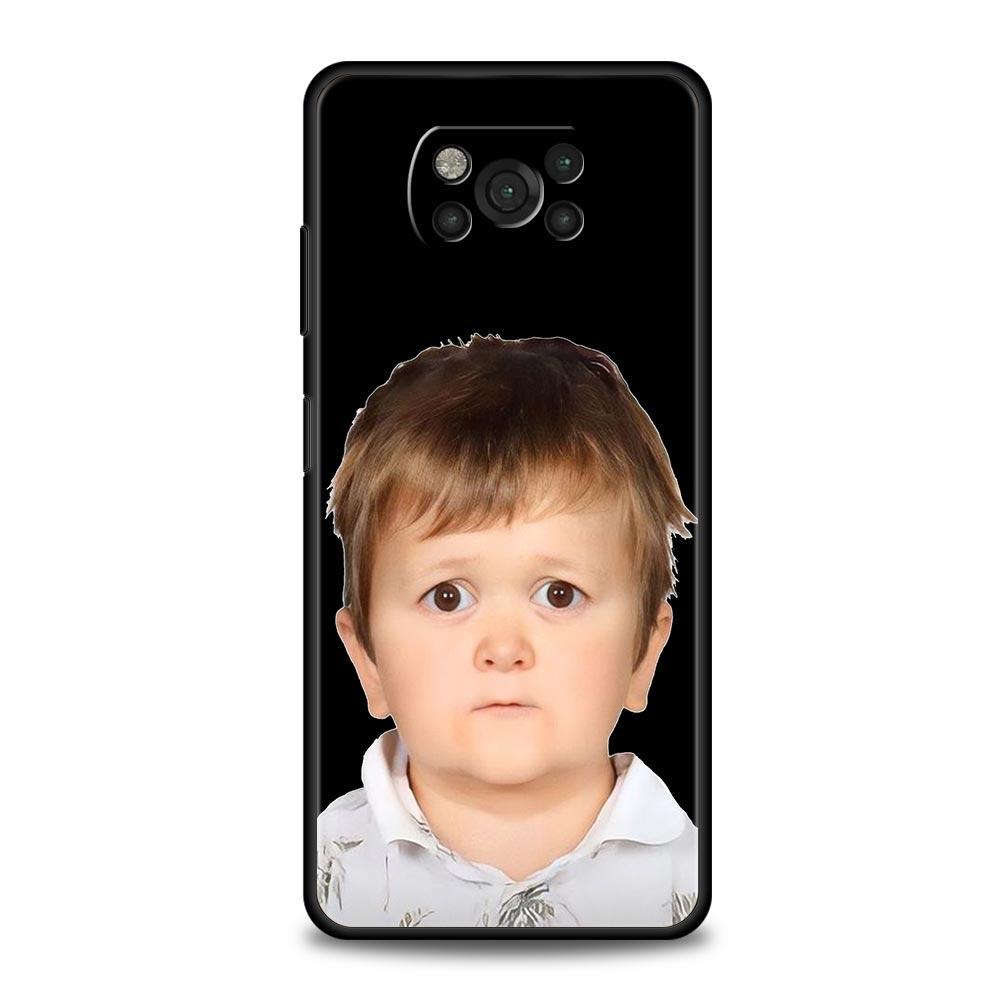 Funny Hasbulla Phone Case For Xiaomi Mi Poco X3 NFC M3 F4 F3 M4 X4 Pro 5G Note 10 12 Lite 11 11T 10T 11X 13 12T Pro 9T Cover
