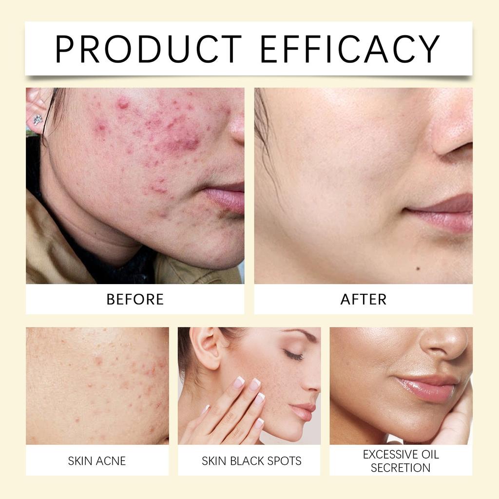 Cleansing Pads For Face And Body, Compressed Facial Sponges, Gentle Cleanser For All Skin Types Pure Natural Ingredients 3ml