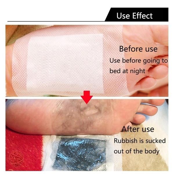 Hřejivé detoxikační náplasti na nohy Vycpávky Tělové toxiny Péče o nohy Čisticí bylinné lepidlo