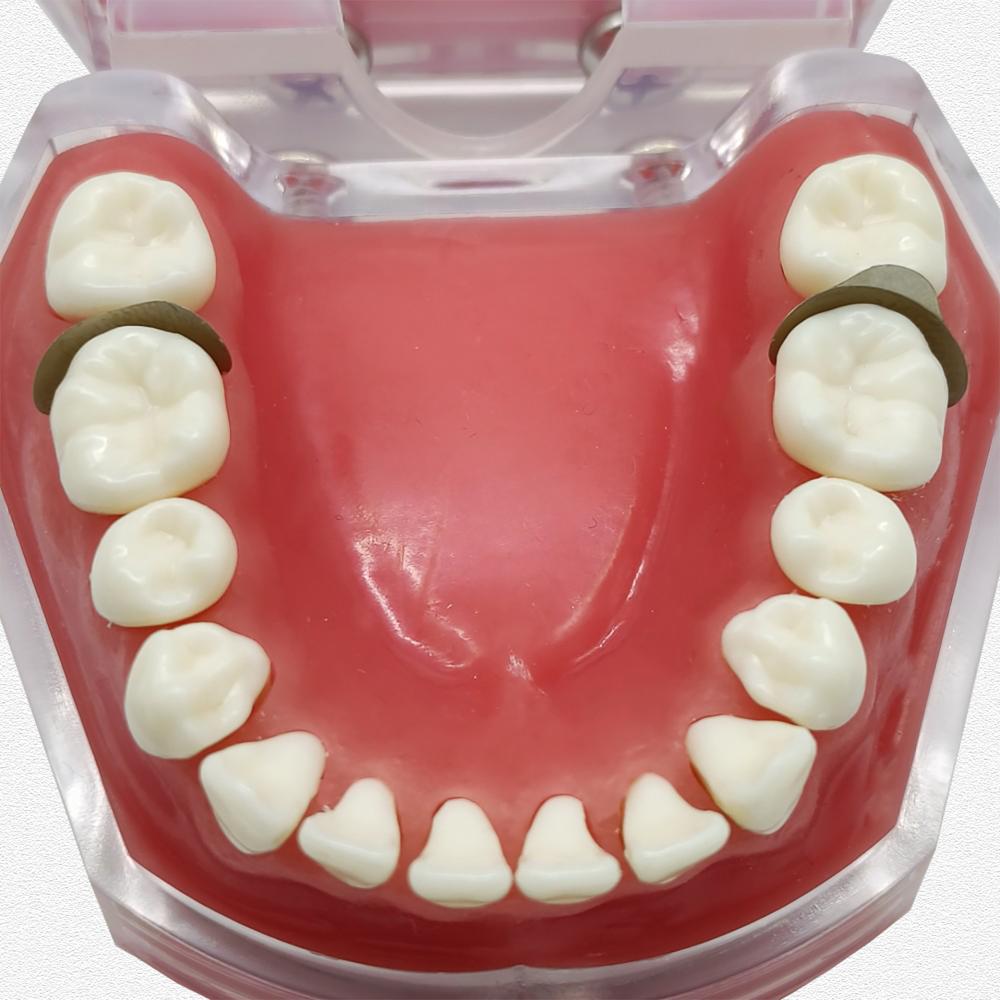 20 szt./60 szt./120 szt. Matryce stomatologiczne profilowane sekcyjne Matryce Matrix Bands Tofflemire Stuck materiał do laboratorium dentystycznego S/M/L