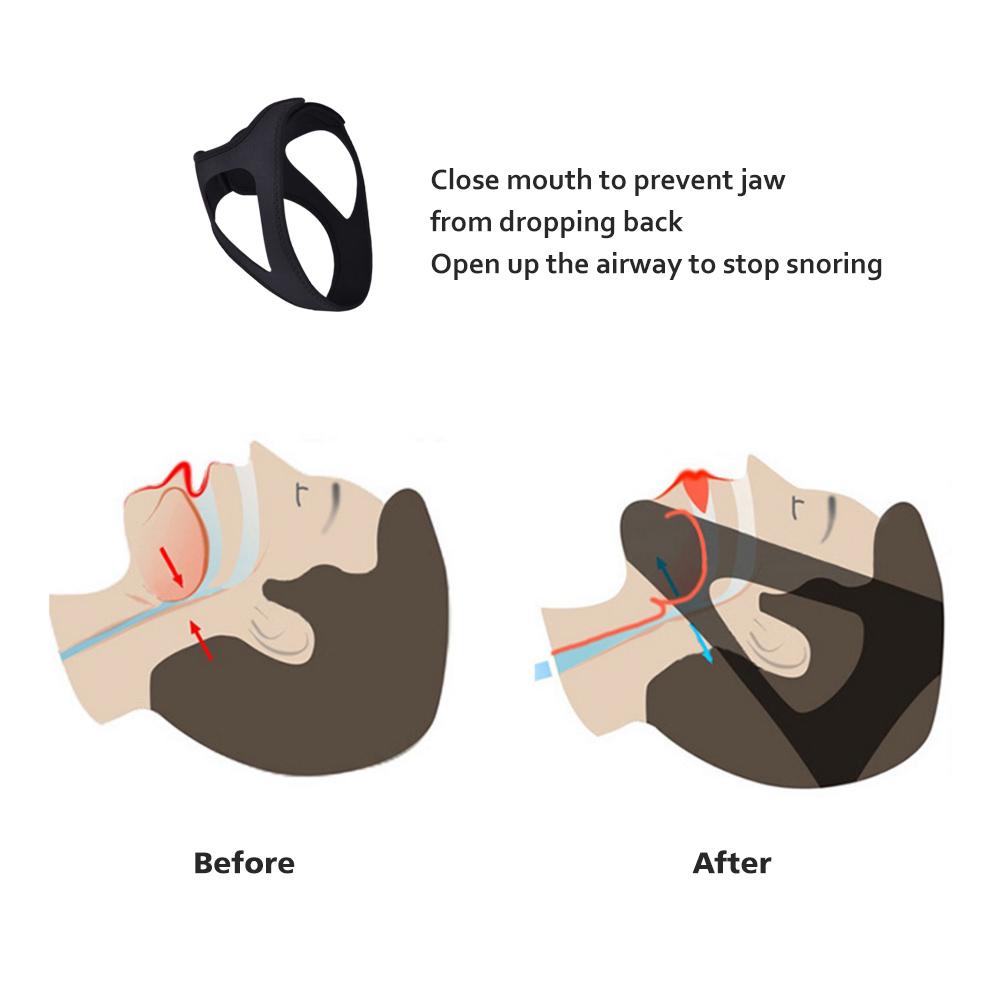 1Pcs Anti Snore Chin Strap,Anti-Dry Mouth Chin Strap For Cpap Users, Stop Snoring, Snoreless Sleeping Solution For Men And Women