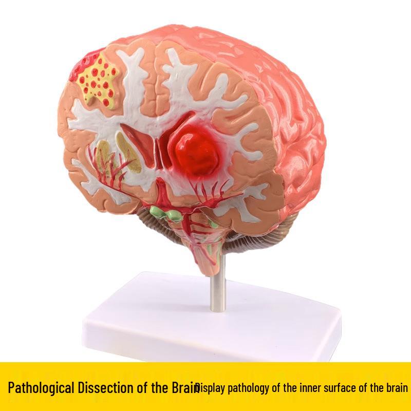Съемная 4D модель человеческого мозга - Функциональная нейронная структура и анатомия тканей