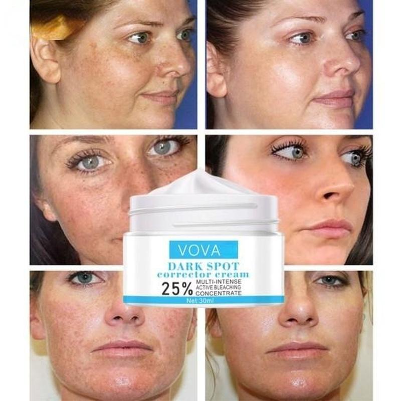 Fade Melanin Natural Extract Dark Spot Cream