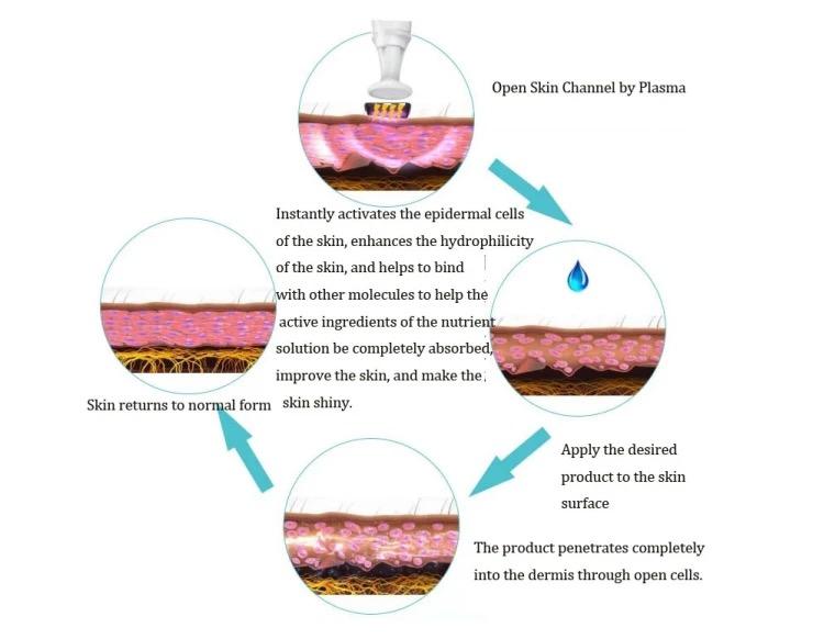 Rivitalizza la Tua Pelle Con la Penna al Plasma Ozono Per il Trattamento dell'Acne, Ringiovanimento Cutaneo, Riduzione delle Cicatrici, Rassodamento della Pelle
