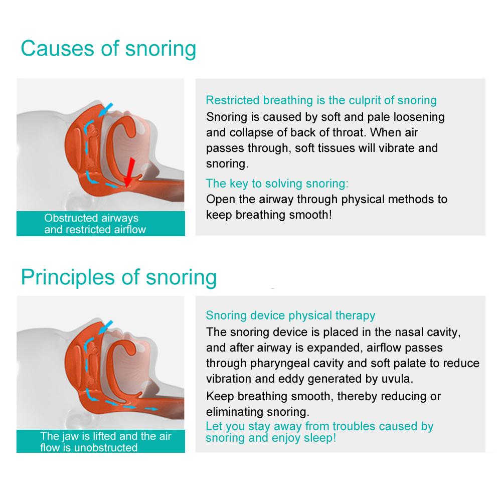 Anti Snoring Solution Devices Electronic Anti Snoring Device Comfortable Sleeping Aid Device
