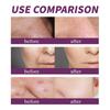 20% Niacinamide B3 Concentrated Skincare Anti Aging Color Removal Pore  Shrinking Spot Fading Wrinkles and Wrinkles 20ml