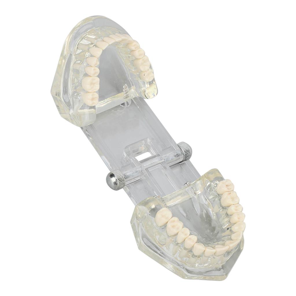 Transparent Dental Model Clear Structure Educational Dental Teeth Display Model for Dental Clinic