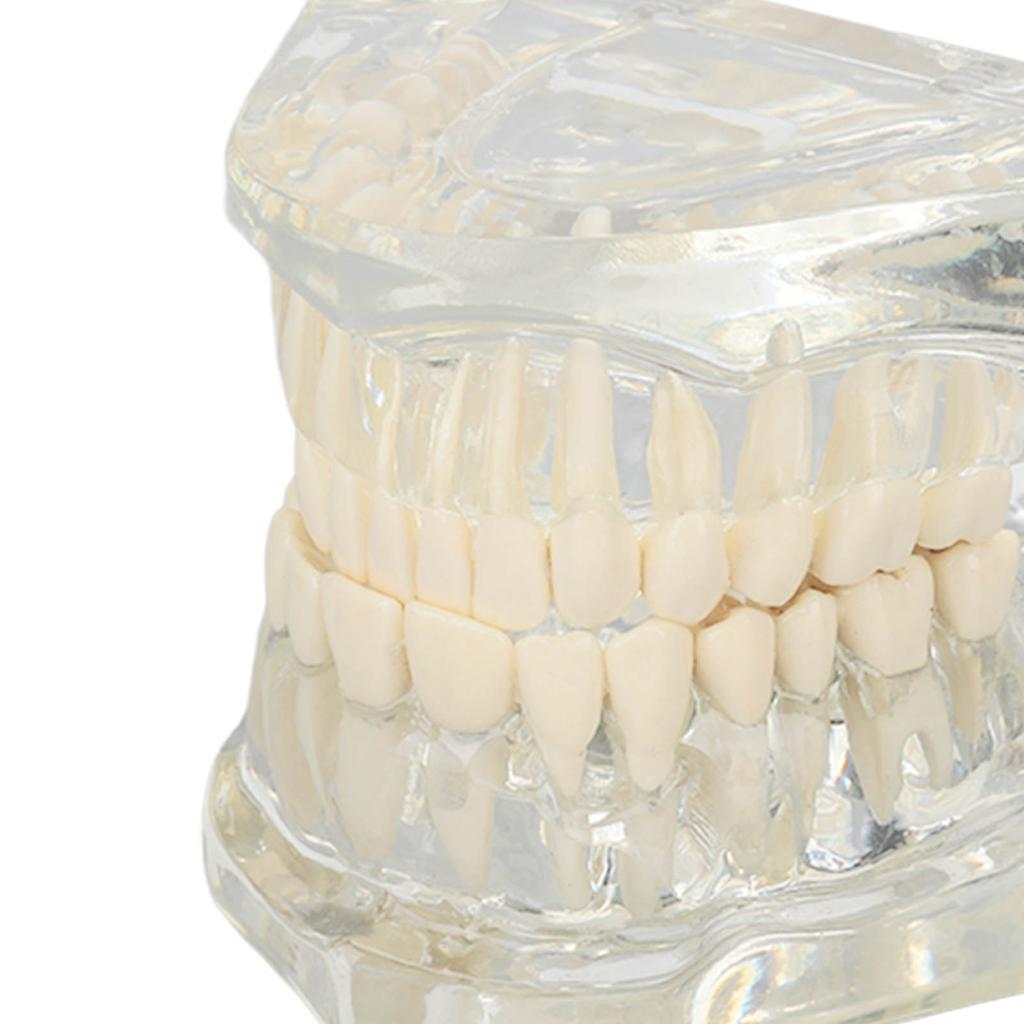 Transparent Dental Model Clear Structure Educational Dental Teeth Display Model for Dental Clinic
