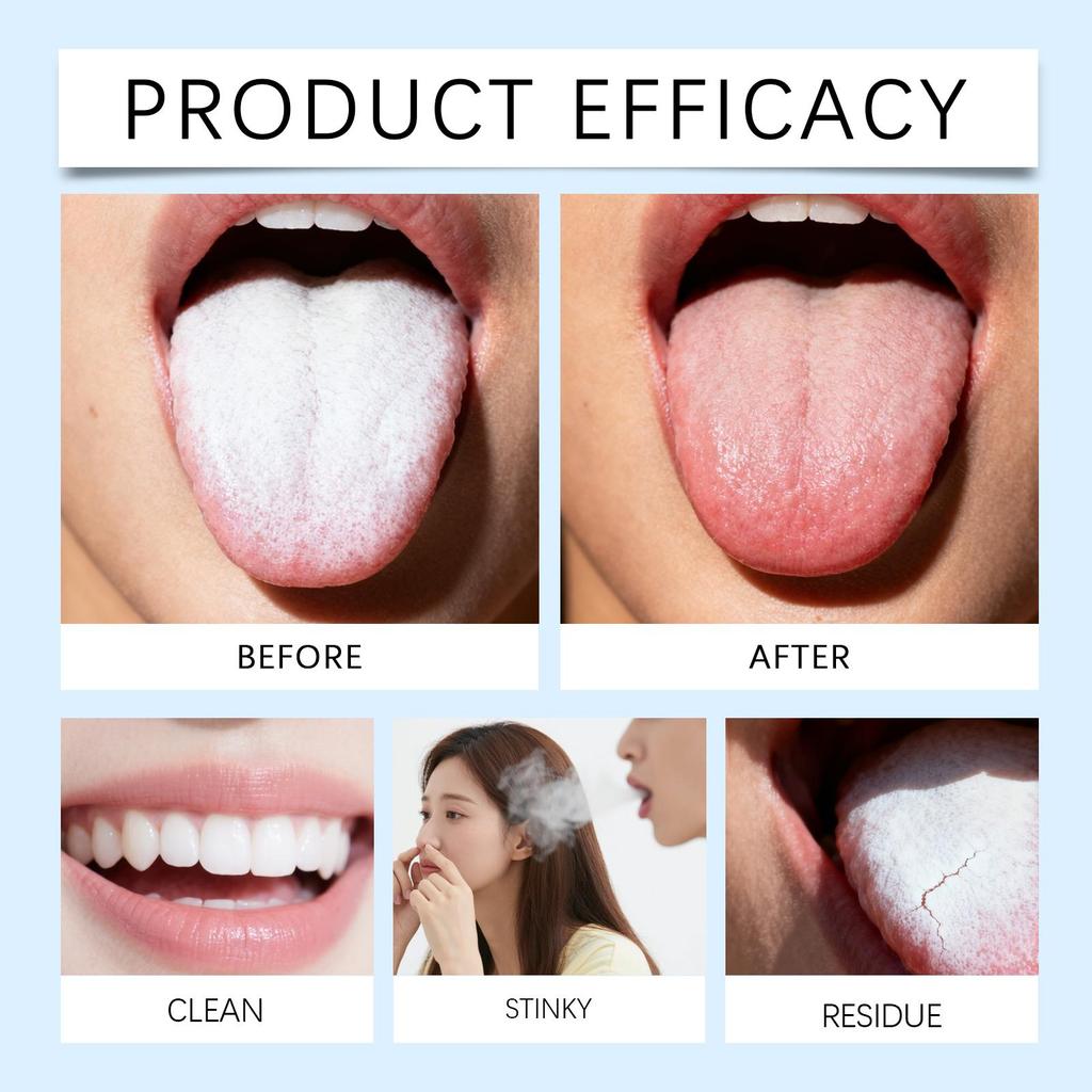 Oralhoe Tongue Cleaning Gel with Tongue Scraper, Long Lasting Fresh Breath, Fights Bad Breath, Oral Hygiene Product, Tongue Cleaner 45g