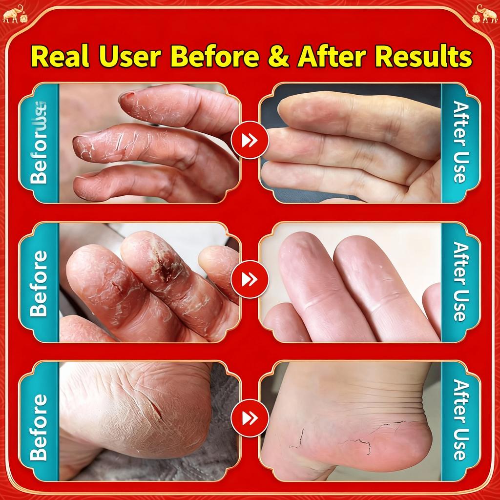 Soin Multifonction pour la Peau – Réparation Intensive pour les Rugosités sur les Mains, les Talons et les Genoux