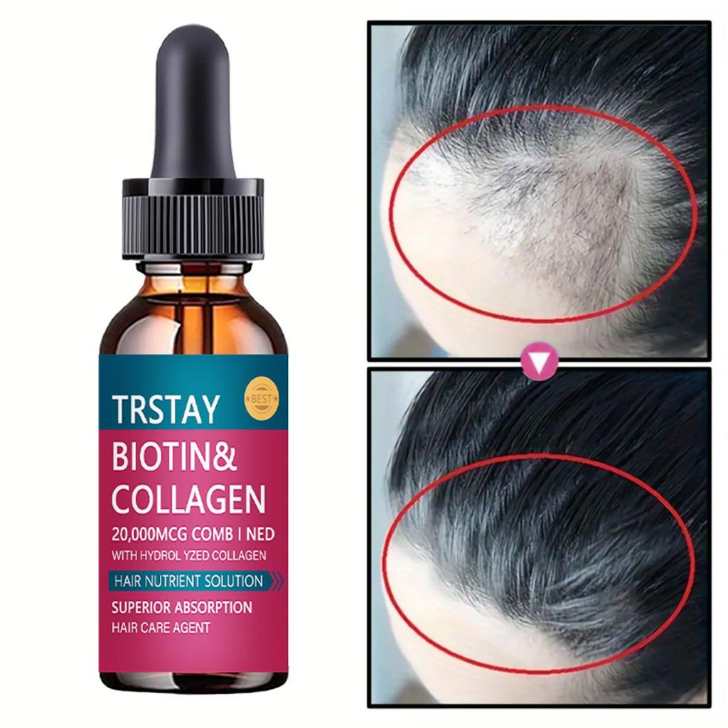 5 ML/15 ML/30 ML/50 ML/nye ingefær hårvekstprodukter Hurtigvoksende hår essensiell olje forhindrer hårtap Olje hodebunnsbehandling for menn kvinner