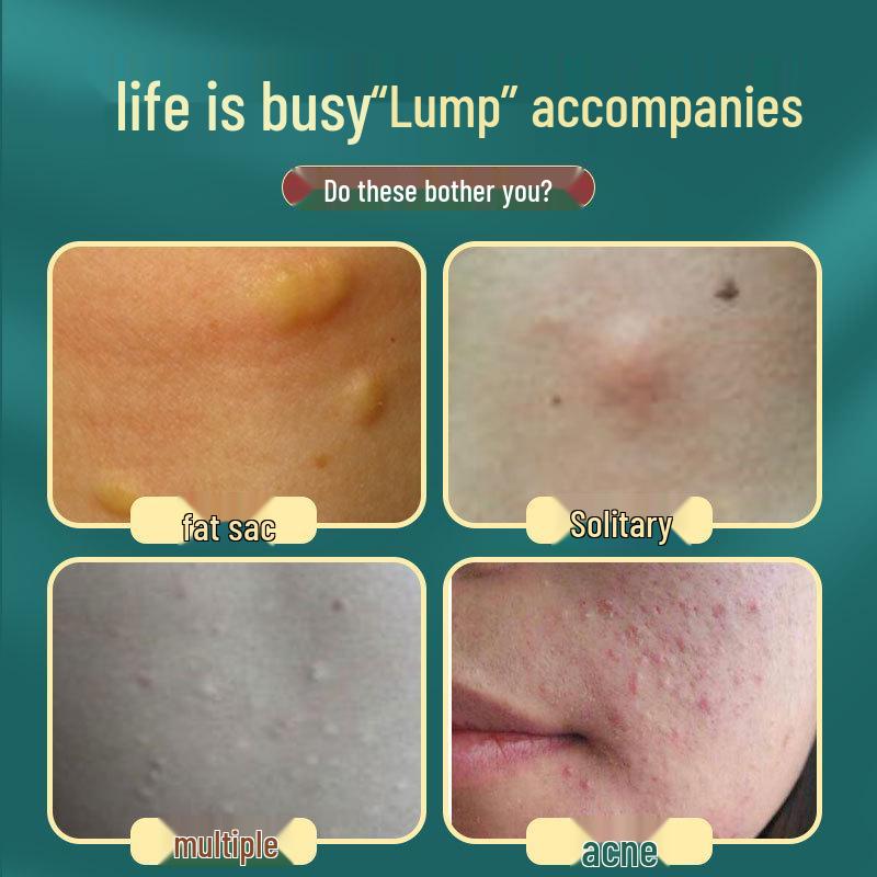 

Крем для подкожного жира в стиле Douyin Mugwort