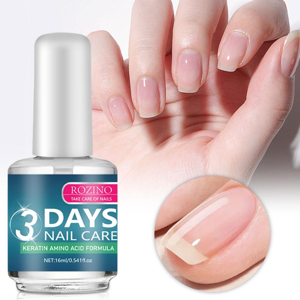 ROZINO 16ml 3 Days Nail Care Serum Repair Nail Fungus Paronychia Relieve Cracked Damaged Toenails Strengthener Nail Care Serum