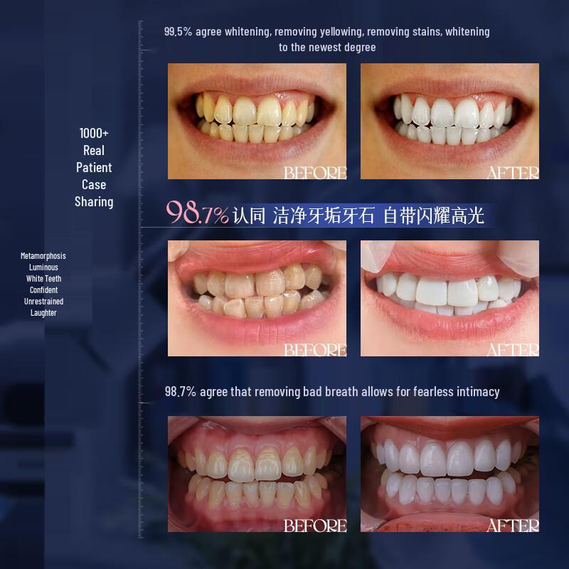 OHBT Teeth Whitening & Fresh Breath Oral Care Collection