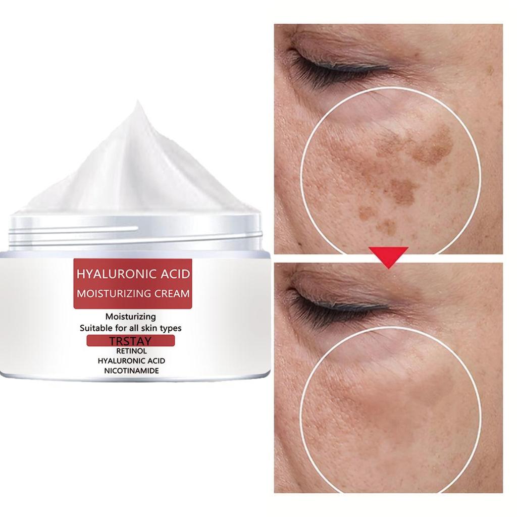 Anti-aging Cream, Rich In Collagen, Prevents Dry Lines, Moisturizes and Moisturizes, Effective Whitening and Freckle Removal Cream