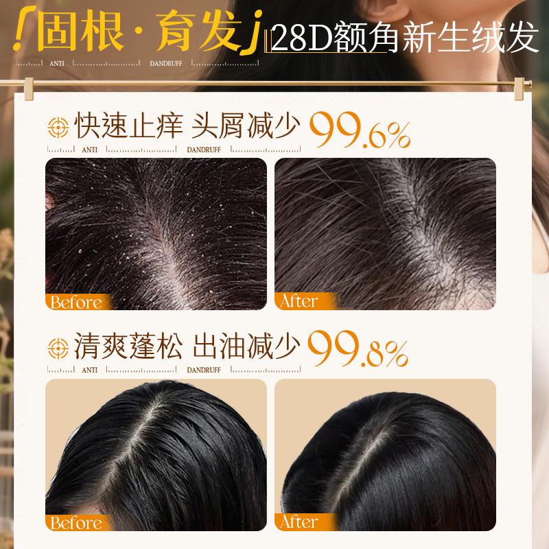Ruyi Polygonum multiflorum ginger root anti hair breakage shampoo 800ml
