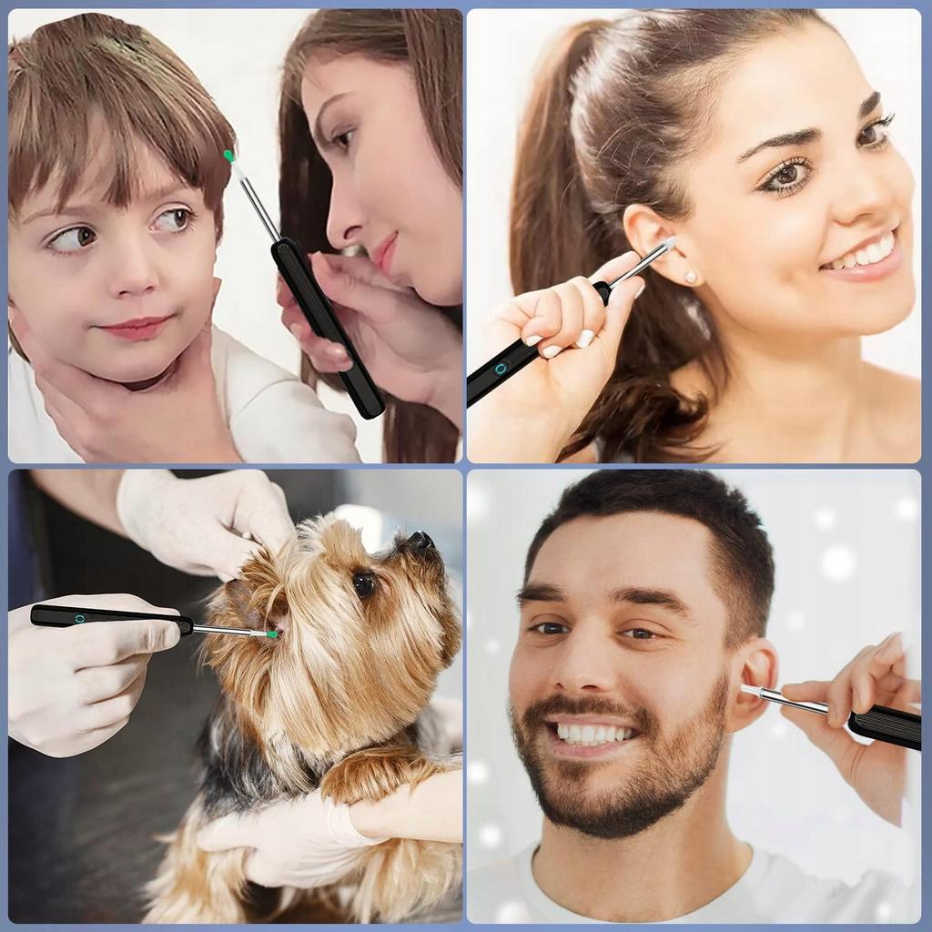 Smart Otoscope Camera Ear Cleaning Wax Wifi Hd Application Endoscope