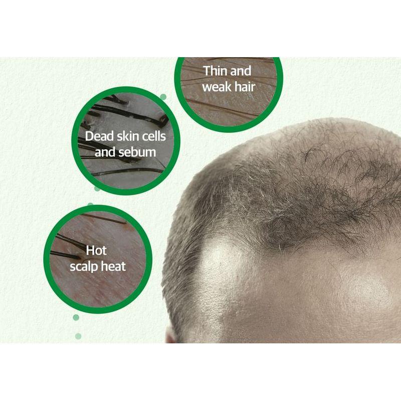 SOME BY MI Cica Peptide Anti Hair Loss Derma Scalp Tonic