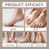 Urea Cream, Foot Balm Sticks Dryness, And Foot Moisturizing Sticks Improve Chapping And Roughness
