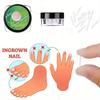 10Pcs Toenail Straightening Clippers Toenail Correction Tools Set Nail Care Elastic Stickers Pedicure Foot Care Tools