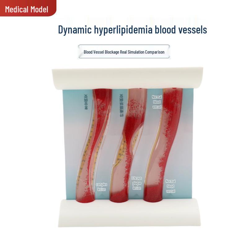 Dynamic Vascular Occlusion and Hyperlipidemia Pathology Model