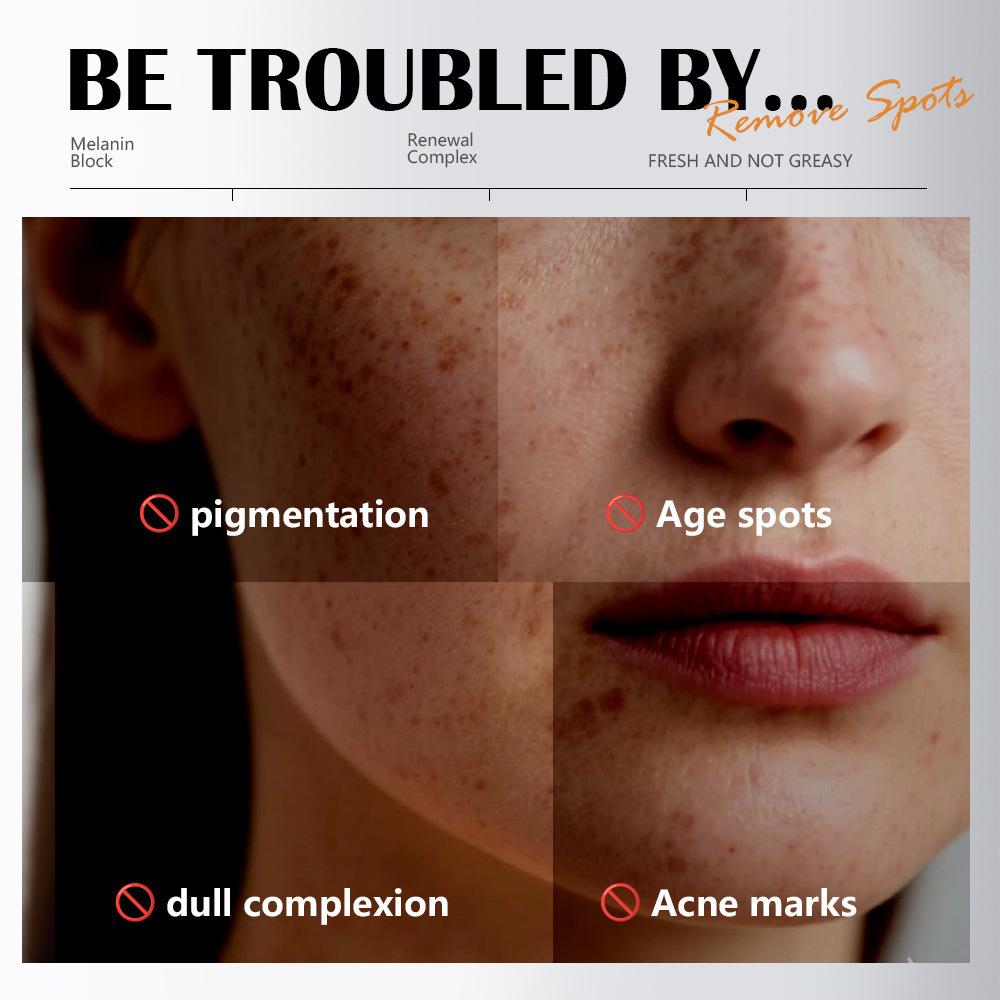 MAYCHEER Niacinamide Acne Serum: Blackhead Remover, Pore Minimizer, Cuticle Softener.