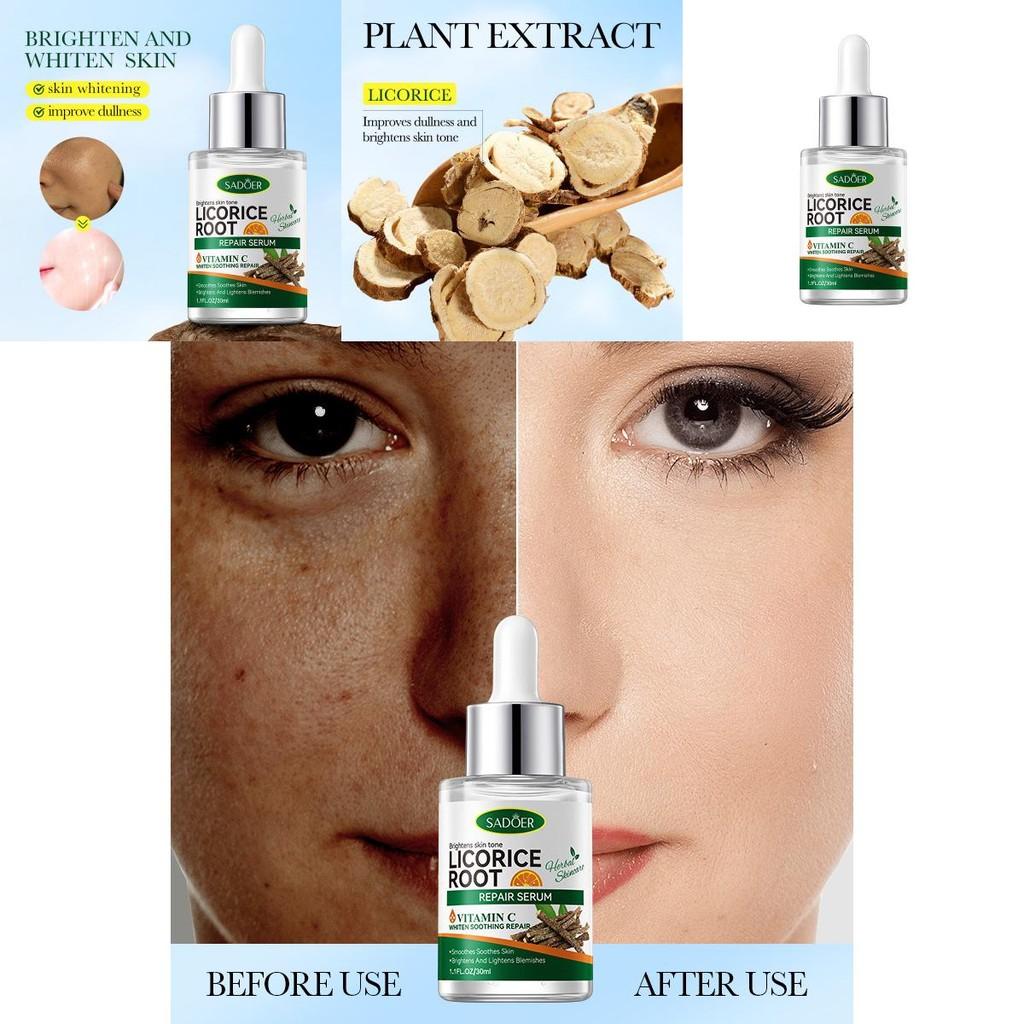 Sadoer Glycyrrhiza Vc Hydrating Essence For Radiant Skin With Moisturizing Benefits And Universal Appeal 30ml