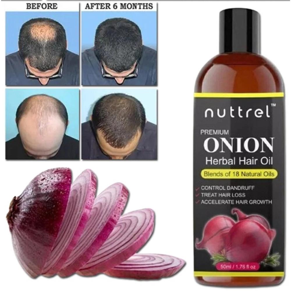 Hair Treatment Oil with Red Onion 50ml | Oil blends of Black Seed, Pure Argan, Sandalwood & Rose | For Rapid Hair Growth